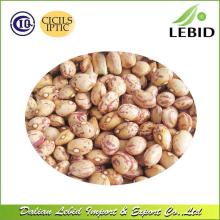 Low Price Light Speckled Kidney Beans Round Shape Xinjiang Origin