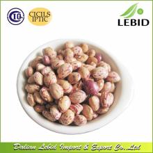 High Quality Light Speckled Kidney  Beans   Xinjiang  Origin